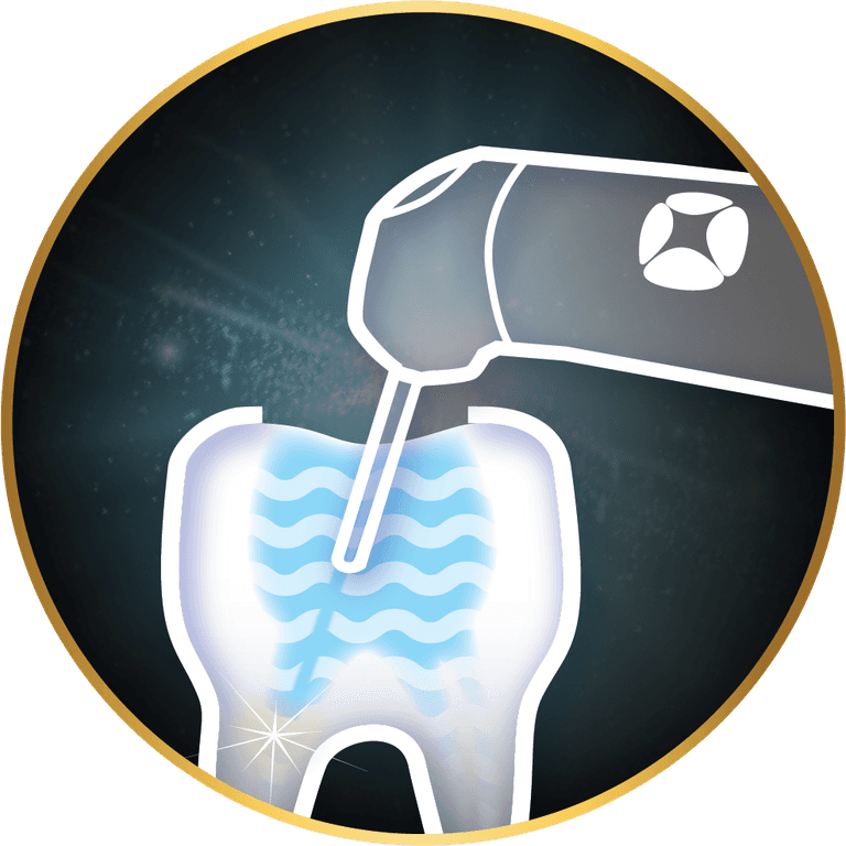 Endodonţie