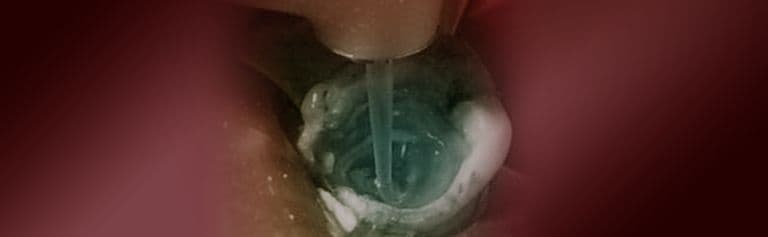 Endodontics-Red-Banner