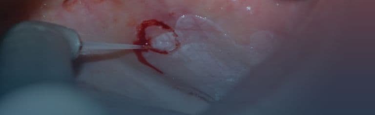 Oral-Pathology-red-banner