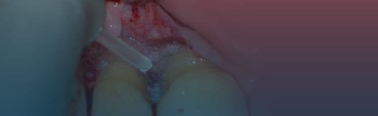 Periodontics-red-banner