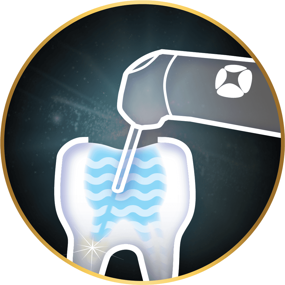Endodonţie